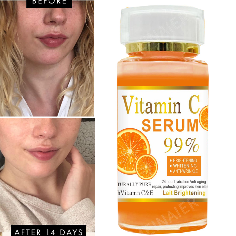 Vitamin C Serum - Suero de vitamina C súper 120ml,
