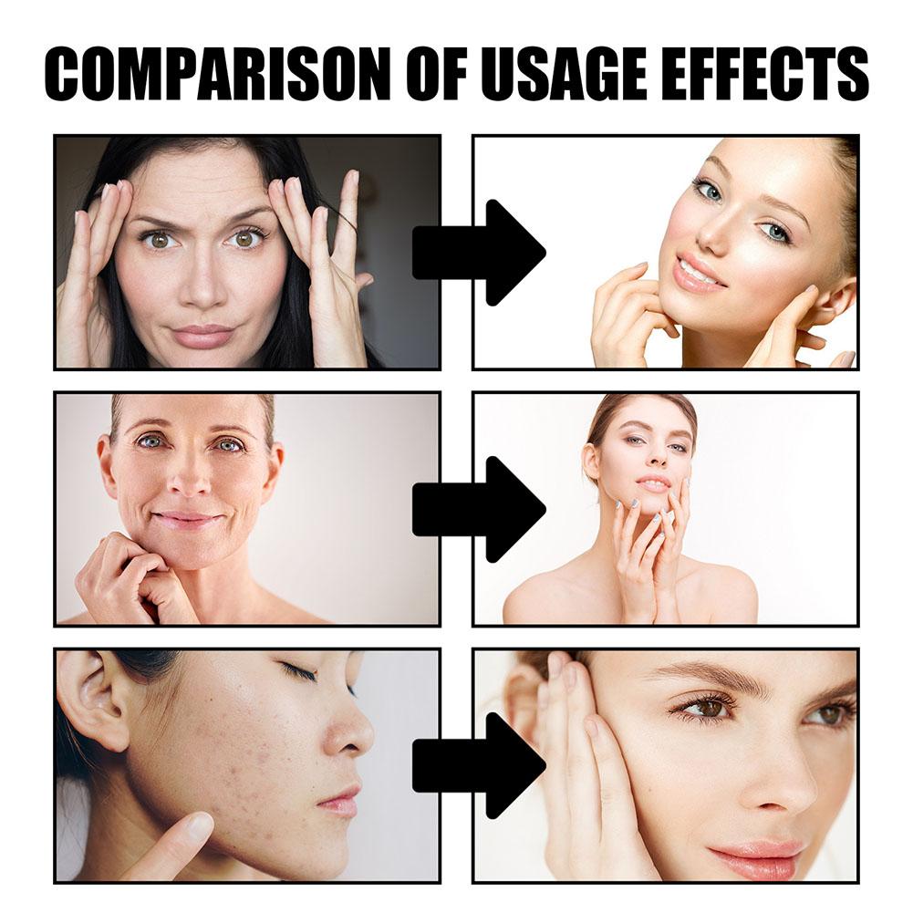 Crema de sangre de dragón para - Retinol Cream reseña y precio