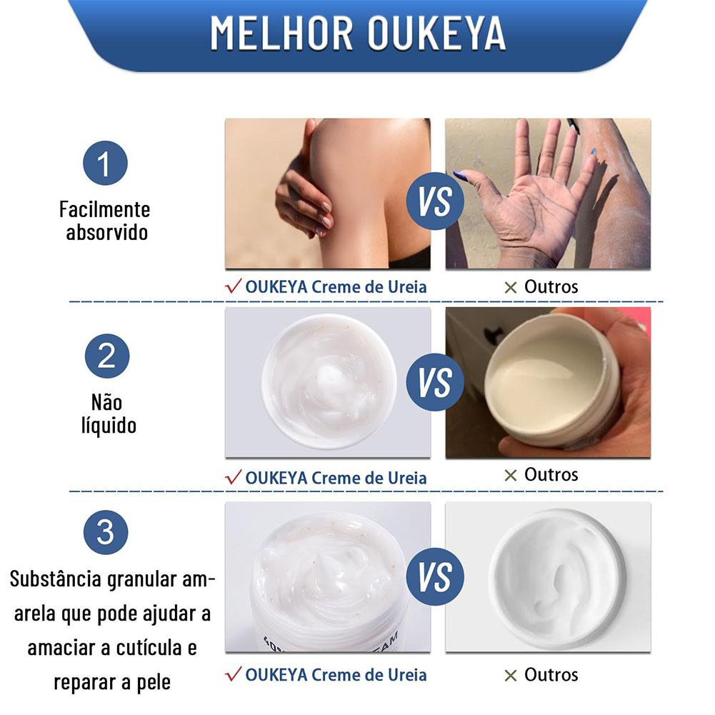 Crema de Urea al 40%, Crema Hi - Urea Foot Cream reseña y precio