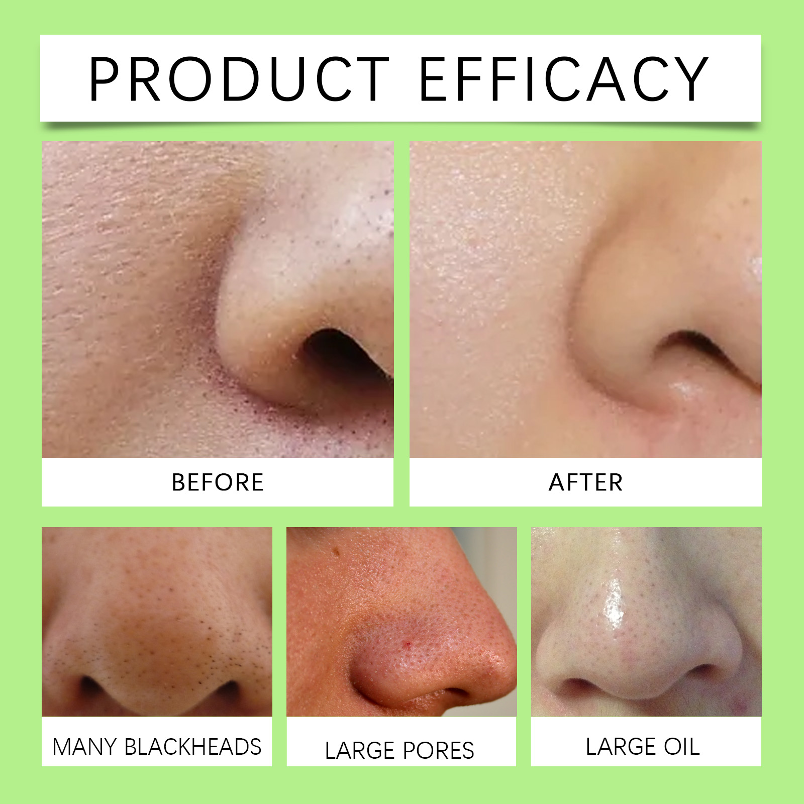 Tiras Nasales de Carbón de Bam - Skincare China reseña y precio