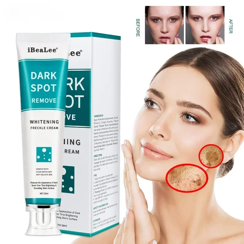 Crema blanqueadora para pecas, - Skincare Glowing reseña y precio