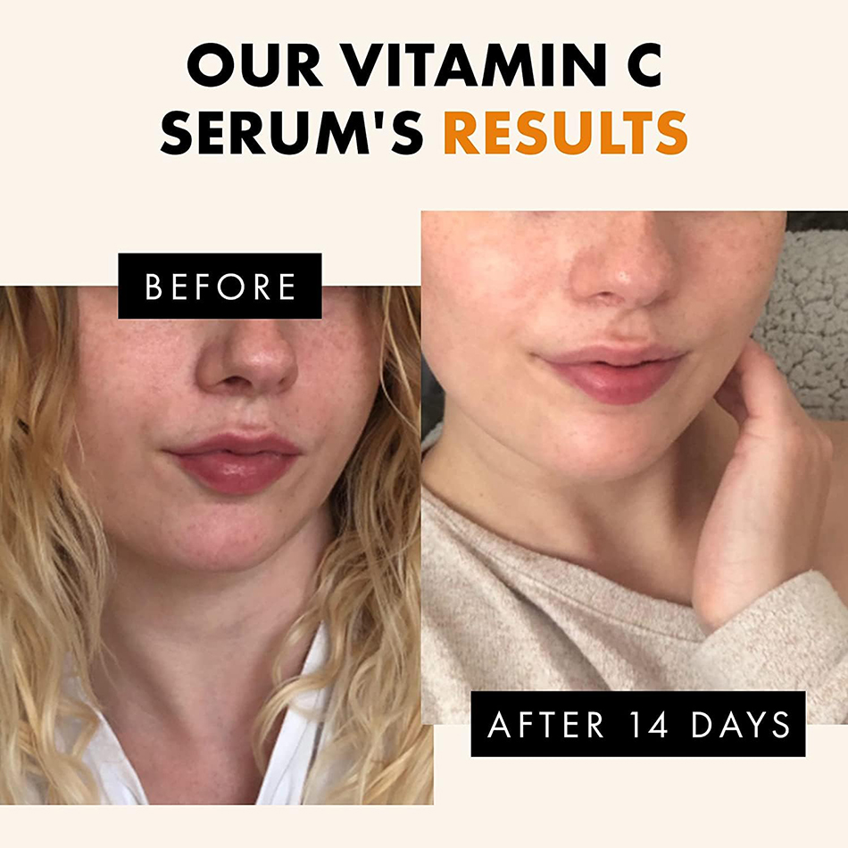 Suero de vitamina C súper 120m - Vitamin C Serum reseña y precio